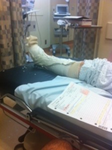 Lisa-Broken-Ankle